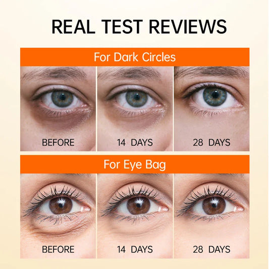 InstaLift™ Anti Wrinkle Eye Cream